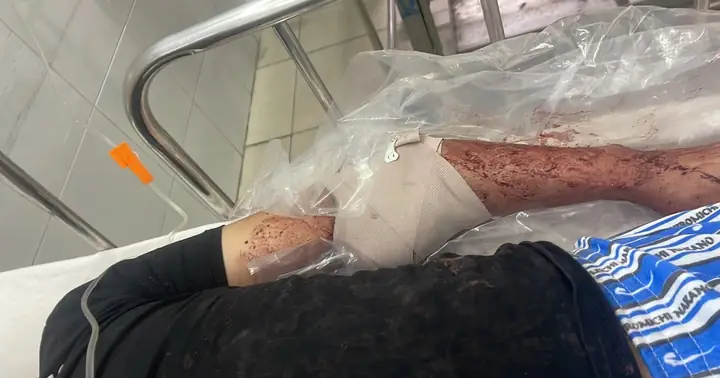 Cá Viên Chiên Đà Nẵng - Hương Vị Đặc Trưng Miền Trung