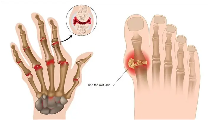 Tác Dụng Của Rau Xuyến Chi